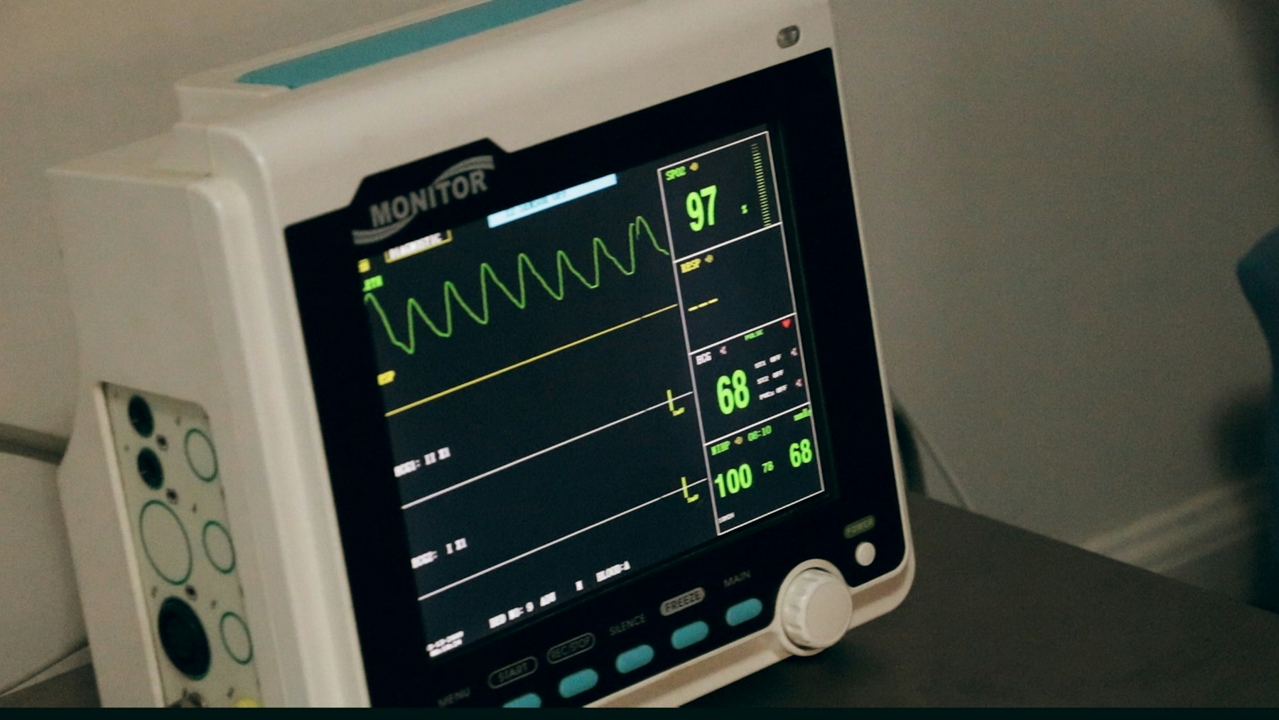 Patientenmonitor mit Vitalwerten